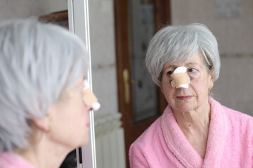 Senior woman recovering after a nose job 