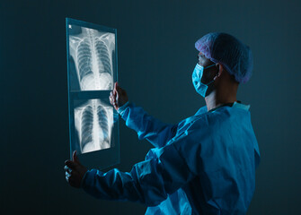 lung radiography concept. radiology doctor examining at chest x ray film of patient at hospital room.