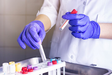 hands of a laboratory assistant with a blood sample and fortitude with blood samples . laboratory assistant holding a blood sample for research