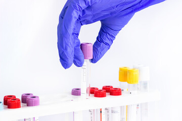 hands of a laboratory assistant with a blood sample and fortitude with blood samples . laboratory assistant holding a blood sample for research