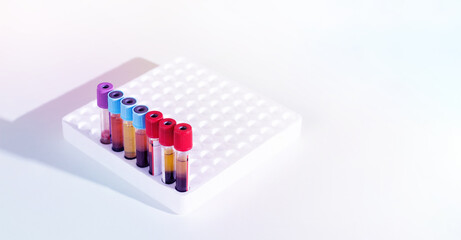 Blood and plasma samples  in test tube. Experimental studies of Red Blood Cell (RBC) and Plasma in...