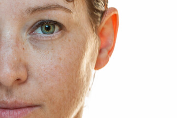 Naturally strong portrait half-sided of a woman without make-up with sun spots on her face