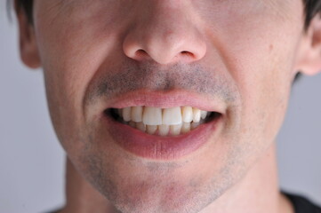 cara sorridente close up nos dentes 