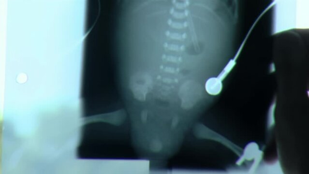 Doctor Holding a X-ray Image of a Newborn Baby in Pediatric Hospital Room. Close Up.