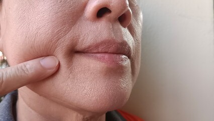 Middle-aged woman with wrinkles on her face.