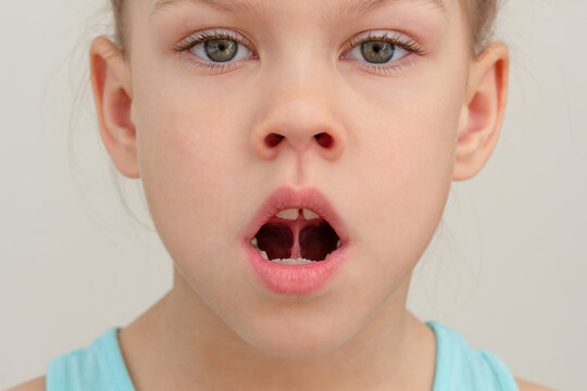 Child face with tongue on upper palate in mouth cropped head caucasian little girl of 6 7 years on grey background