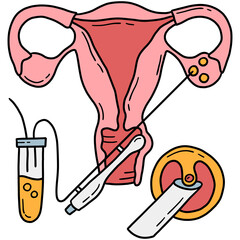 Egg retrieval and transvaginal oocyte extraction from ovaries, In Vitro fertilization