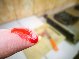 close up, bloody fingers when cutting vegetables for cooking ingredients. the concept of carelessness while cooking