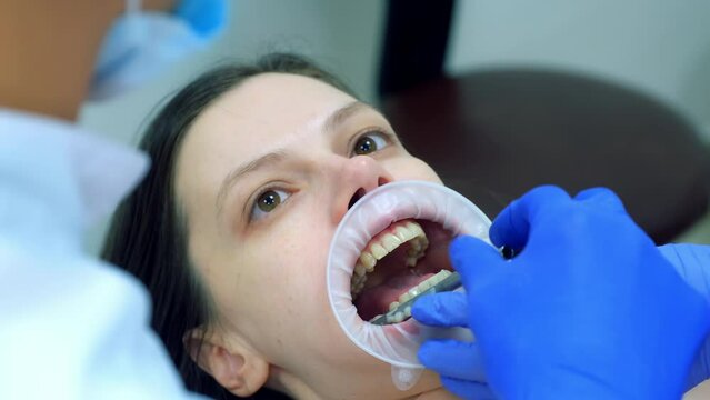 Orthodontist is fixing metal part on woman's patient teeth preparing to condylography. Examination and treatment of mandibular joints. Orthodontology treatment and cure concept. Dentistry and clinic.