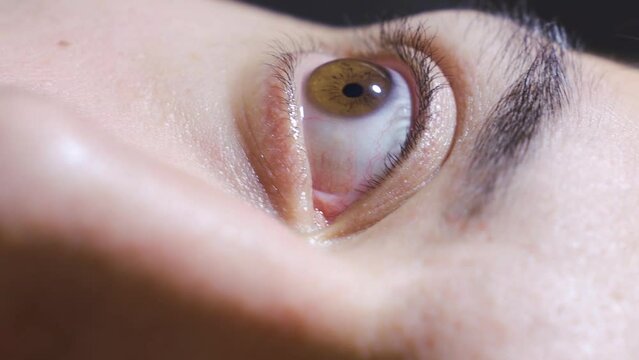 Vertical Video of Close-up of depressed eyes.
Close-up eyes of schizophrenic man.
