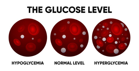 Glucose in the blood vessel. Normal levels, hyperglycemia, hypoglycemia. Normal, high and low blood sugar. Blood diagram. Vector illustration.