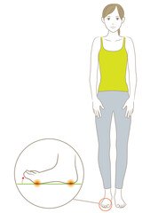 浮き指で悪い姿勢で立つ女性