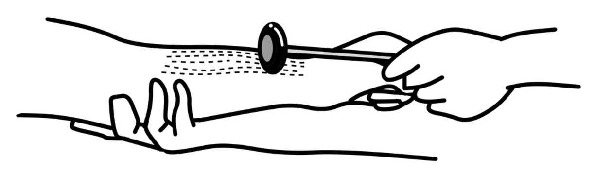 The physical examination of reflex.