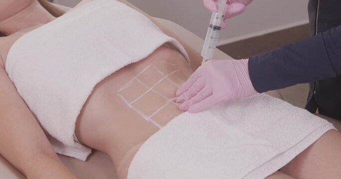 close-up photo of a woman's belly, photo of aesthetics, procedures on the abdomen. beauty clinic. ozone application, ozone therapy, enzymes, slimming. weight loss.