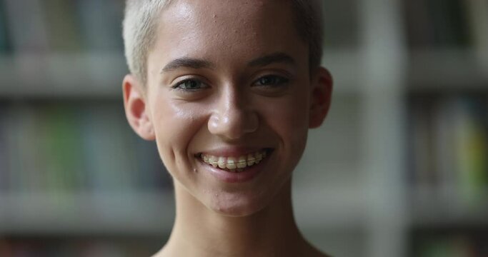 Close up face beautiful teen girl with short blond hair and charming wide smile revealing ceramic dental braces staring at camera, advertises orthodontic treatment for teeth straightening, dentalcare