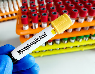 Blood sample for Mycophenolic Acid (MPA) test, to set therapeutic range for MPA, a drug which is use to help to prevent the rejection of organ transplantation including heart, kidney or liver. - obrazy, fototapety, plakaty