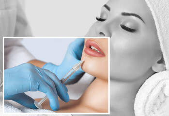 The doctor cosmetologist makes Lip augmentation procedure of a beautiful woman in a beauty...