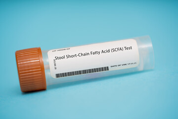 Stool Short-Chain Fatty Acid (SCFA) Test