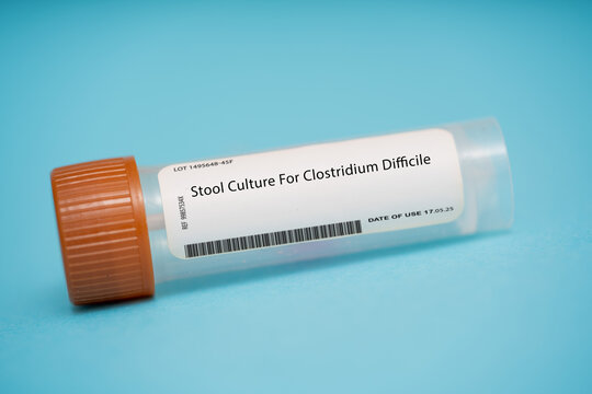 Stool Culture For Clostridium Difficile