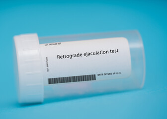 Retrograde ejaculation test - obrazy, fototapety, plakaty
