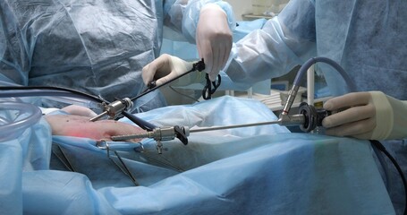 The process of performing endoscopic surgery in an animal on the abdominal cavity. The hands of a...