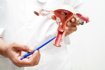 Uterus, doctor holding anatomy model for study diagnosis and treatment in hospital.