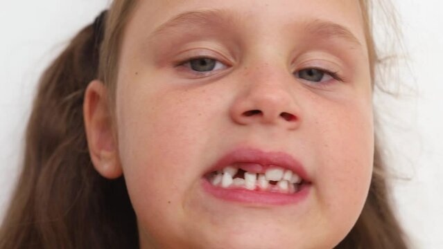 Video shot of small little blond girl with ponytails showing toothless mouth to camera, turning head right and left. Tooth pain and milk teeth treatment, tooth loss and health checking and monitoring