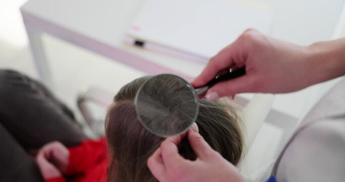 Doctor trichologist holds magnifying glass checking children hair. Difference between lice and nits from dandruff
