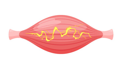 電気が流れた筋肉のイラスト