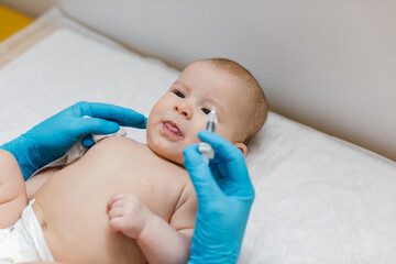 Pediatrician administring oral vaccination against rotavirus infection to little baby. Children...