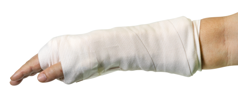 broken arm splinting from accident isolated - Powered by Adobe