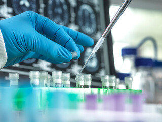 Scientist working with samples for dementia and alzheimers research