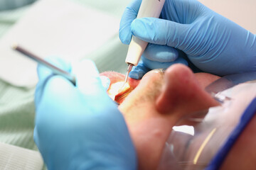 Dentist examines oral cavity of male patient with mirror. Services of dental clinics and dental...