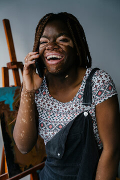 Girl with vitiligo in her painting studio talking on her phone while laughing