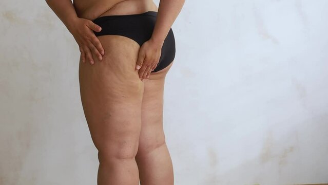 Back view of unrecognizable buxom woman wearing black underwear, squeezing skin of hip, buttock with hands, showing cellulite on white background. Skin care, body care, lymphatic drainage, obesity. 
