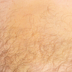 A bruise on the body from a traumatica pistol.A hematoma from a blow.Bruise background.