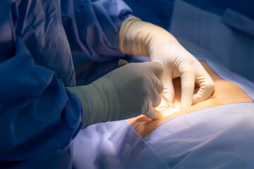 Hand of surgeon or doctor and glove inside operating theater with light technology from surgical...