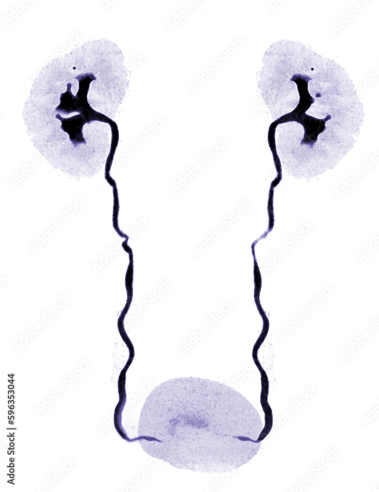 Poster cta renal artery 3d rendering image showing both kidney, ureter and bladder .