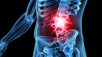 3d medical illustration of lower back pain - obrazy, fototapety, plakaty