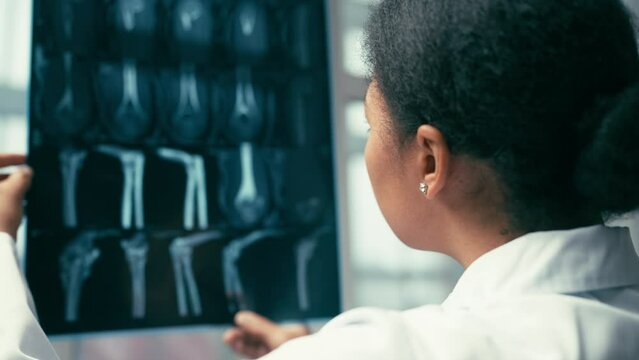 Female doctor examining patient's x-ray image, bone treatment, orthopedics