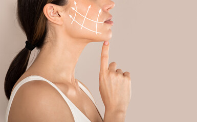 Side view of unrecognizable lady with lifting arrows on cheek - obrazy, fototapety, plakaty