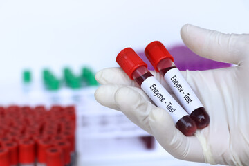 Enzyme test, blood sample to analyze in the laboratory