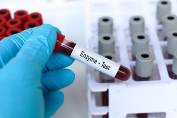 Enzyme test, blood sample to analyze in the laboratory