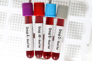 Group blood test, blood sample to analyze in the laboratory