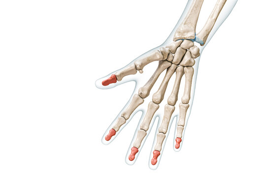 Distal phalanx bones in red color with body 3D rendering illustration isolated on white with copy space. Human skeleton, hand and finger anatomy, medical diagram, osteology, skeletal system concepts.