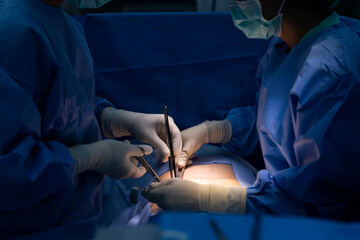 Team of doctor and surgeon or nurse did appendectomy surgery inside operating room in...