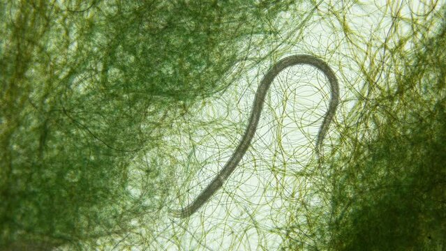Nematoda worm under a microscope, worm movement among Cyanobacteria, widely distributed on ground, is a parasite, exact form is not defined.