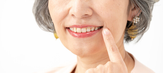 歯並び　白い歯　中高年女性
