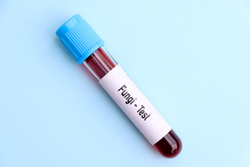 Fungi test, blood sample to analyze in the laboratory