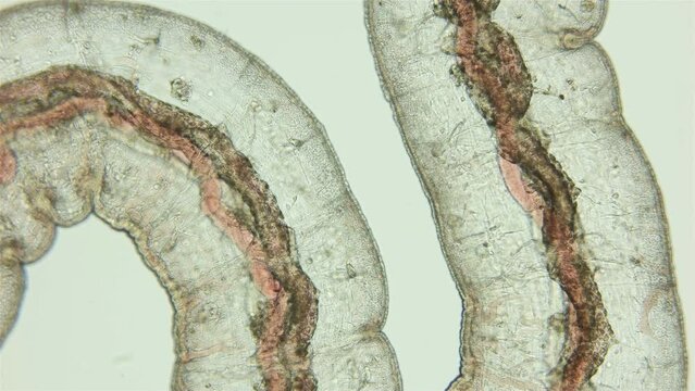Worm from family Naididae under a microscope, possibly Tubifex. Found in silt of a hydrogen sulfide lake. Work of internal organs is visible